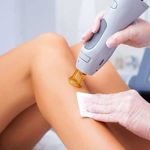 Laser Hair Removal St Michaels Clinic